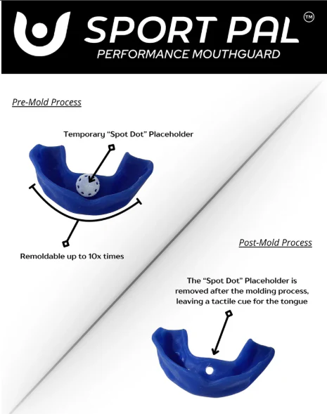Sport Pal Mouthguard - Image 9